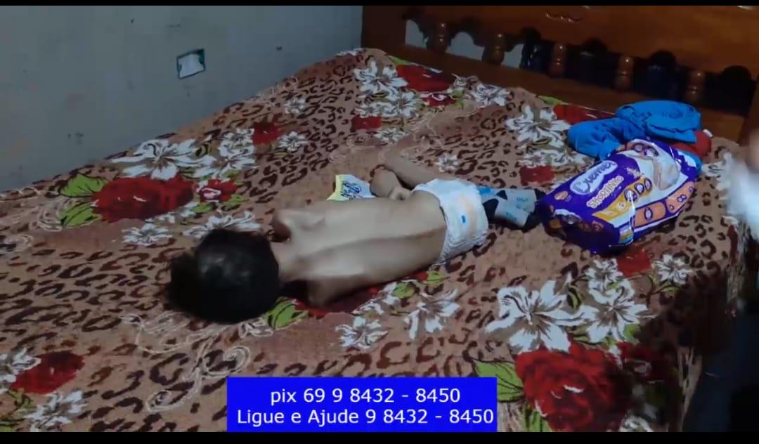 CRIANÇA COM PROBLEMA GRAVE DE SAÚDE, PRECISA DE AJUDA! (URGENTE)