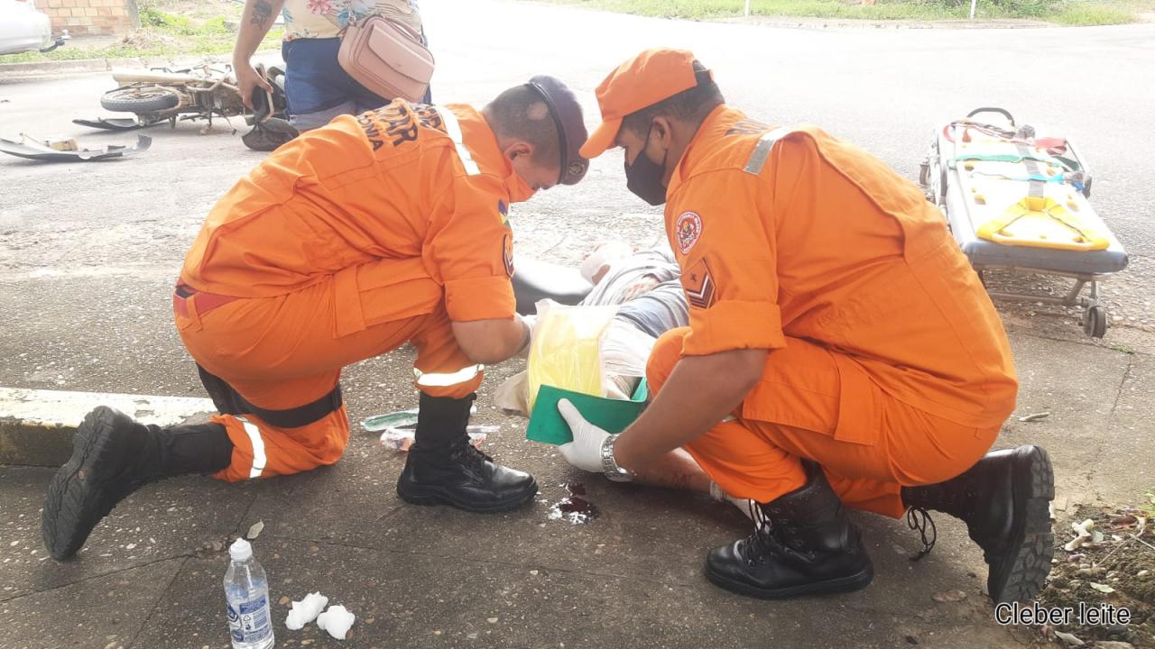 Acidente grave,com fratura exporta no 2º Distrito de Ji-Paraná (Fotos)