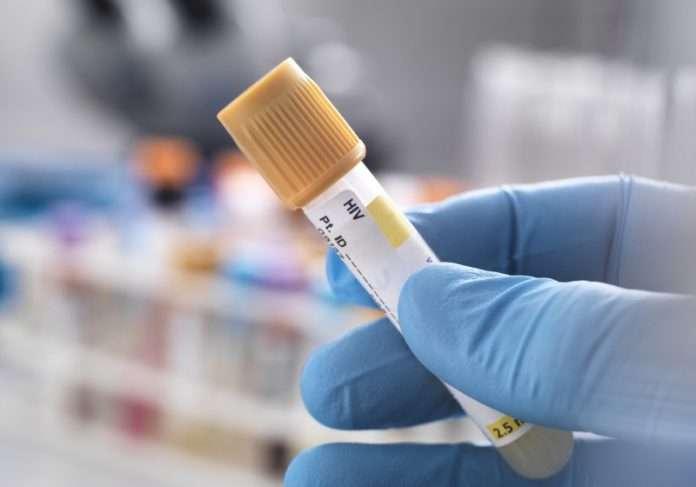 Mulher é curada do HIV após transplante de células-tronco