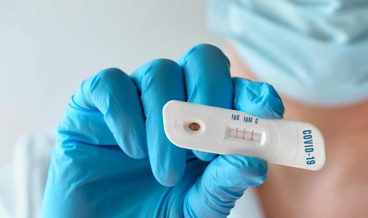 Boletim Covid: Rondônia registra 468 novos casos conhecidos da doença e 4 mortes no domingo (6)