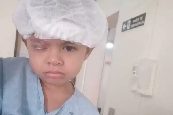 Menina que passou Super Bonder no olho faz cirurgia nesta 3ª feira