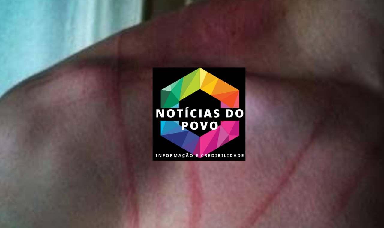 Ji-Paraná Mulher Enciumada Tenta Esmagar Testículos Do Marido, Em Seguida Toma Veneno