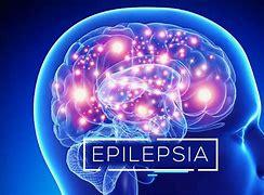 Mãe insiste em cirurgia de retirada de tumor e filho se cura da epilepsia