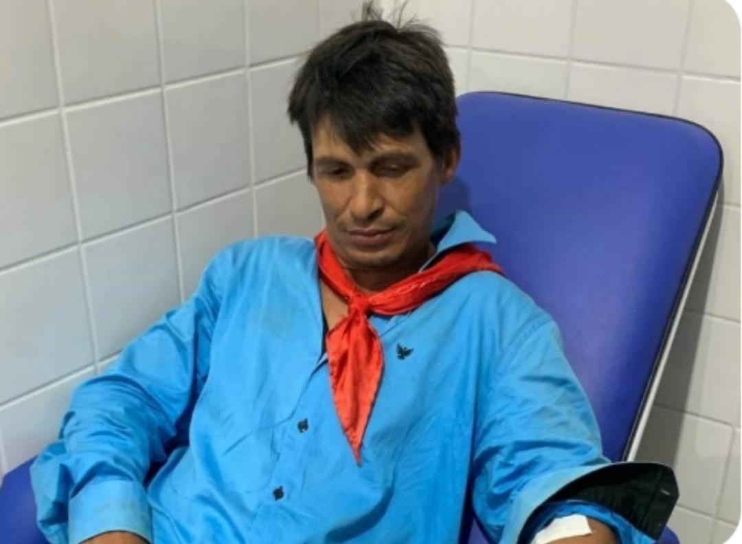 Vaqueiro leva coice de boi, e é atingido por Raio.