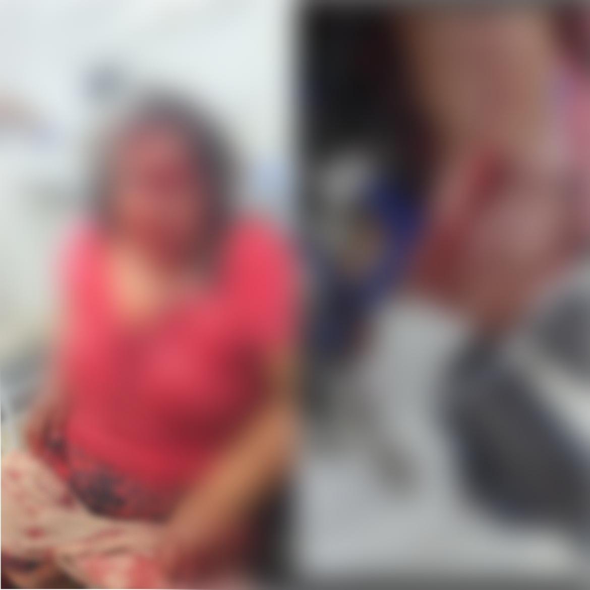 Barbaridade :Mãe tem o rosto desfigurado pelo  filho.