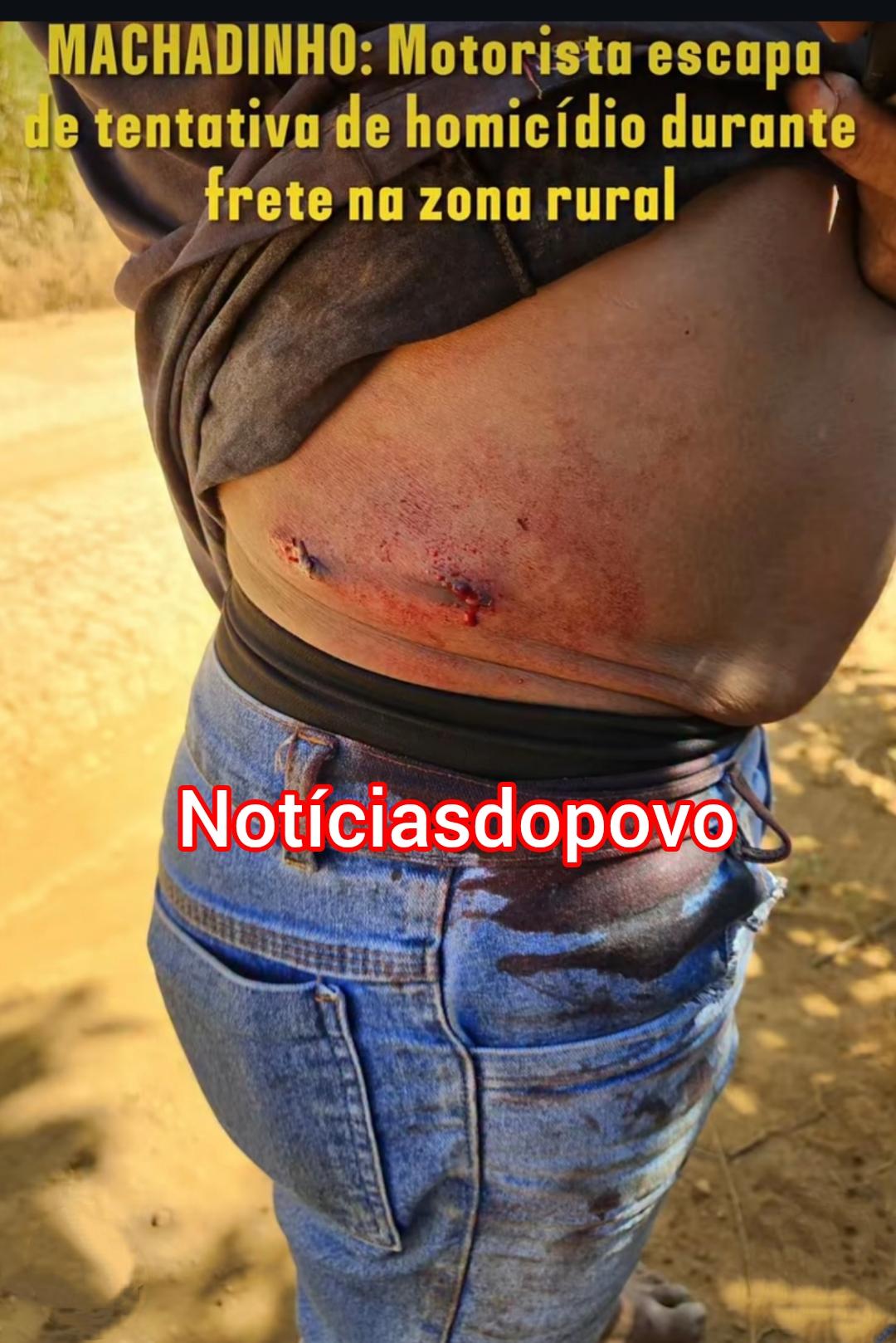 Tentativa de homicídio. 